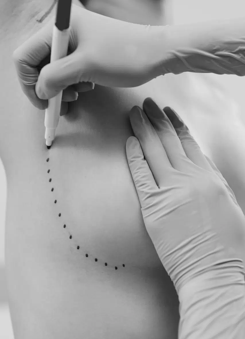 Réduction mammaire | Dr Dannepond | Bordeaux