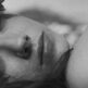 Acide hyaluronique et ovale du visage : redéfinir les contours