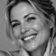 Botox et rides d&rsquo;expression : comment ça fonctionne ?